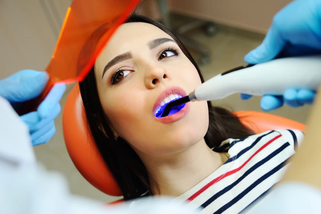 Dental Fillings in Milpitas to Restore Your Healthy, Natural Smile