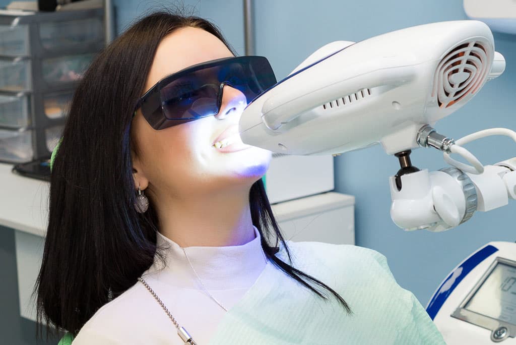 Professional Teeth Whitening in Milpitas for a Brighter, Whiter Smile in One Visit