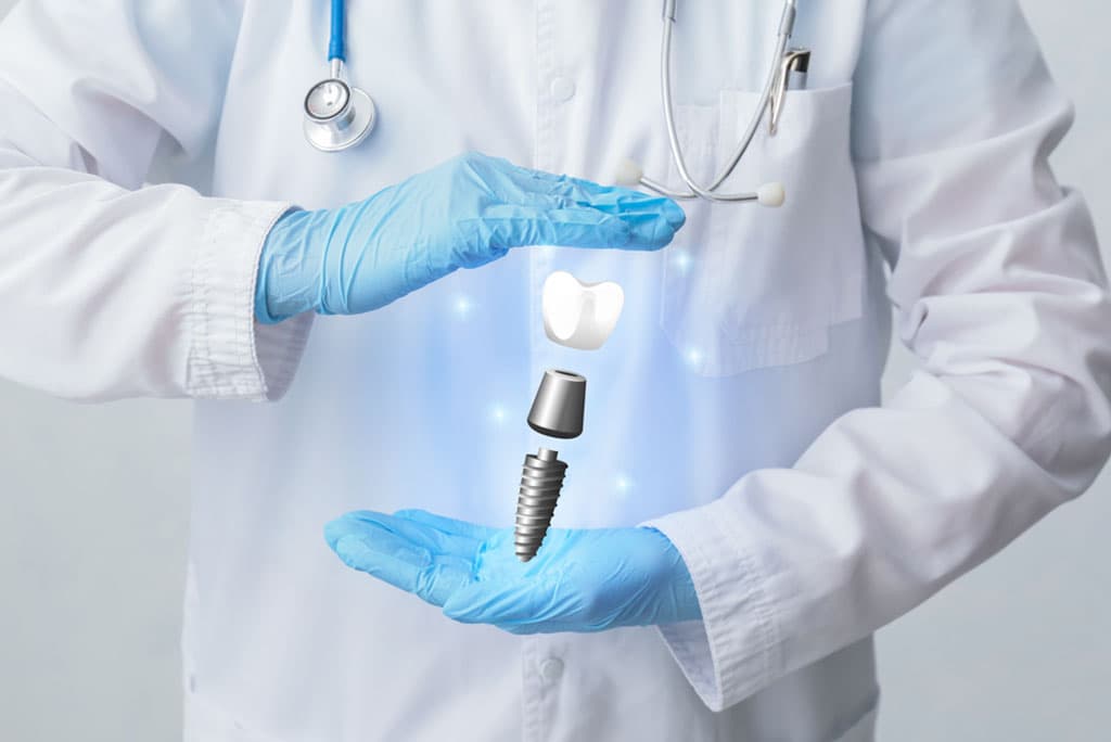 Dental Implants in Milpitas, CA for a Permanent, Natural-Looking Smile