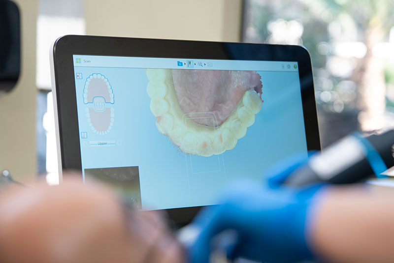 3d scan of Patients mouth