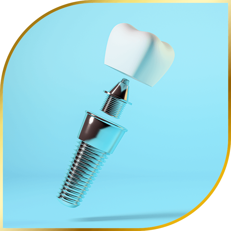 Dental implant
