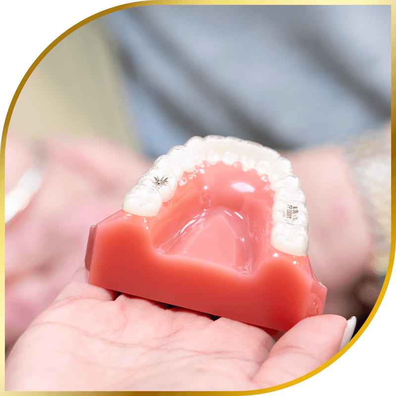 Invisalign