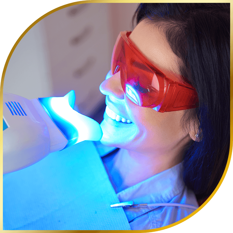 teeth whitening