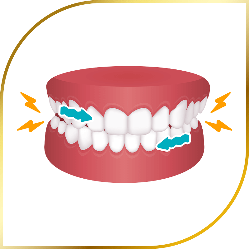 Grinding teeth